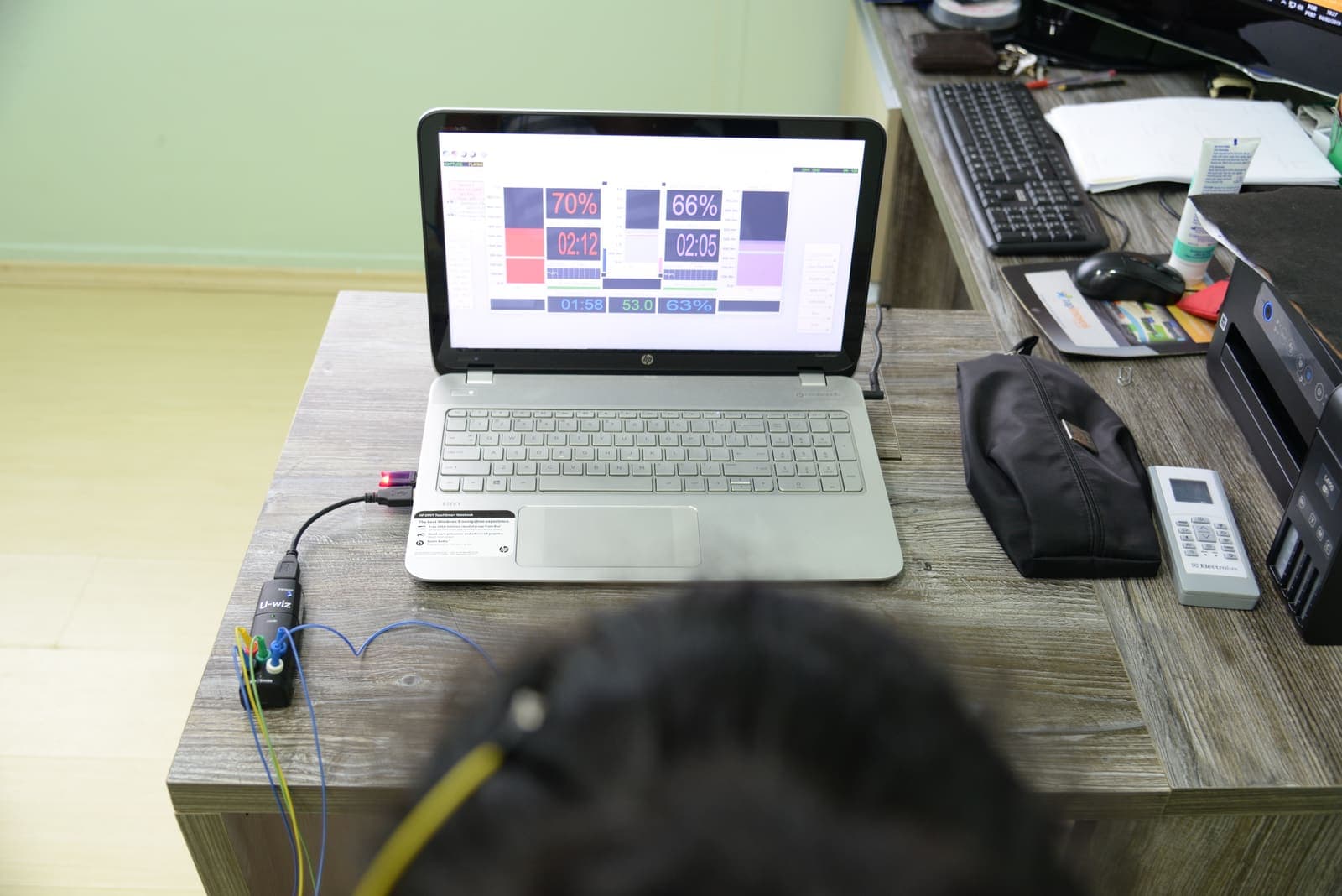Neurofeedback